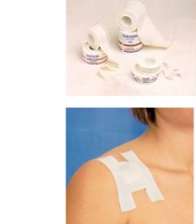 CEROTTO SU ROCCHETTO IN COTONE AREATO E ASSIDO DI ZINCO EUROREEL MISURA 5X5 1 PEZZO - doctorpill.it